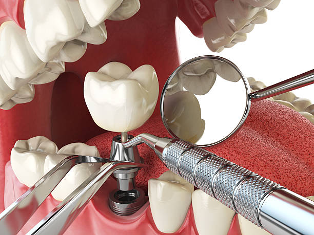 Best Emergency Orthodontic Repairs in East Porterville, CA